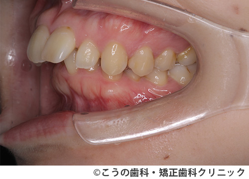 treat_case04_a2.jpg