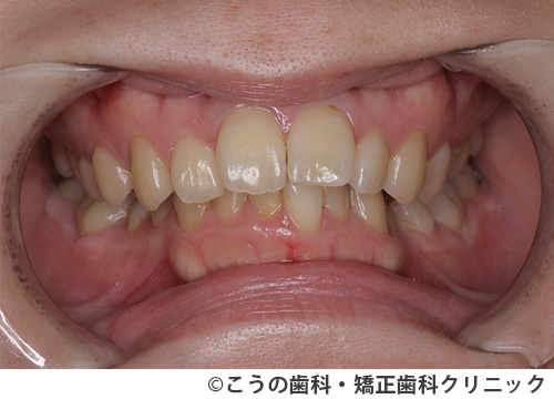 treat_case04_a3.jpg