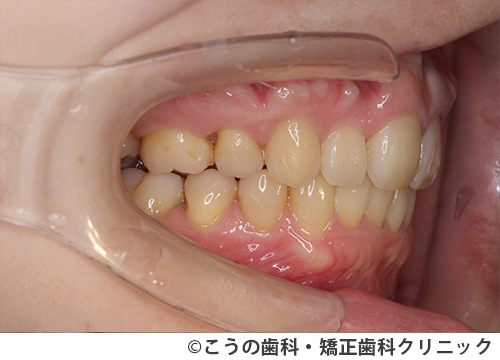 treat_case04_b1.jpg