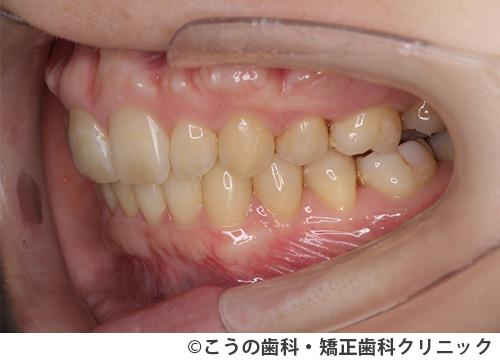 treat_case04_b2.jpg