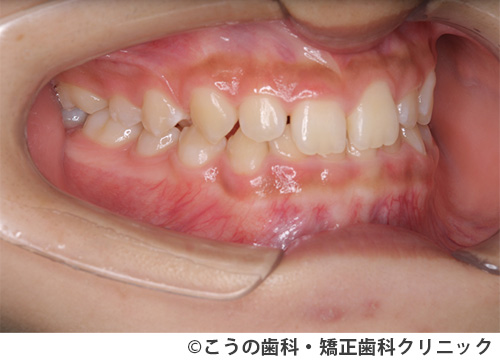 treat_case05_a1.jpg