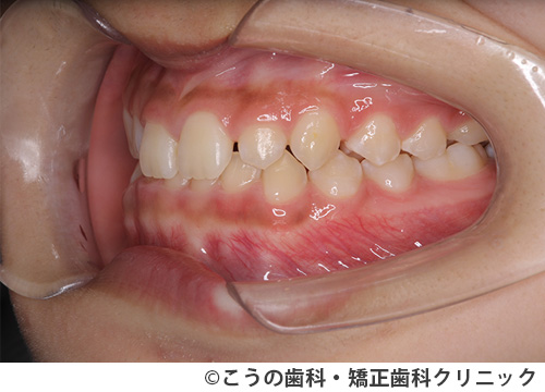 treat_case05_a2.jpg