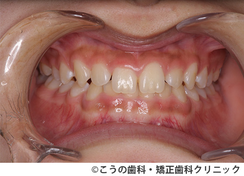 treat_case05_a3.jpg