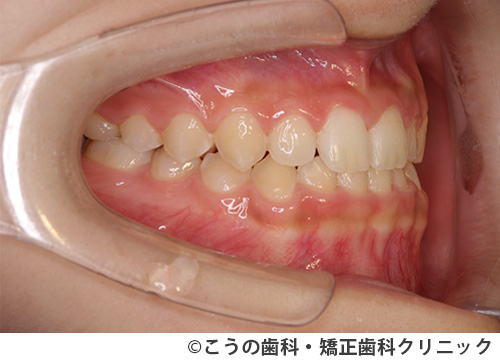 treat_case05_b1.jpg