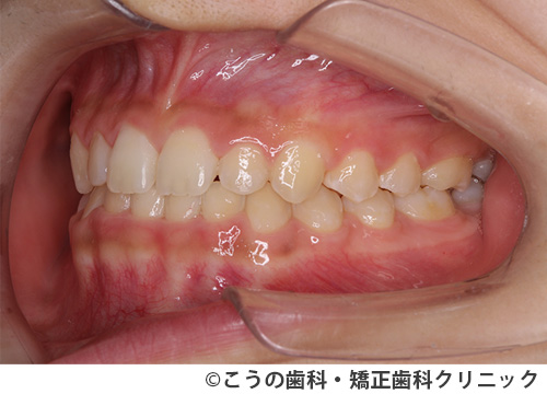 treat_case05_b2.jpg