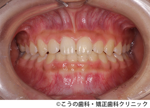 treat_case05_b3.jpg