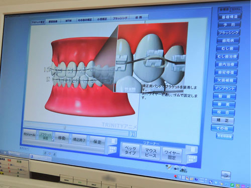 ������˥�