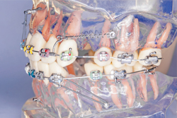 ���ʶ����ѥ��󥫡�������塼���Ѥ�������