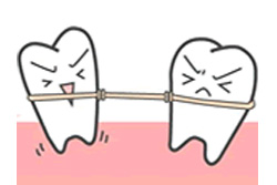 噛み合わせの改善