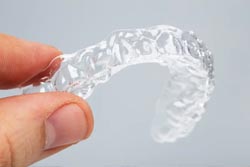 マウスピース矯正を導入
