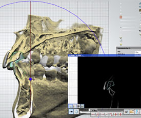 3Dデジタル矯正で不安のない矯正治療を