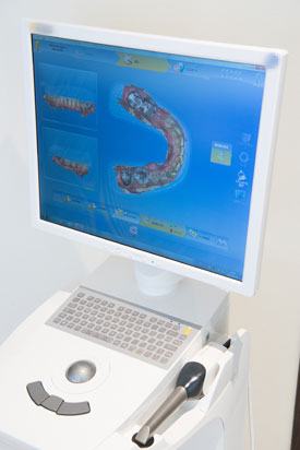 デジタル技術で矯正治療をすることのメリット