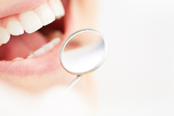 �ޥ����ԡ����ˤ�붺�����Ŵ�λ�����������