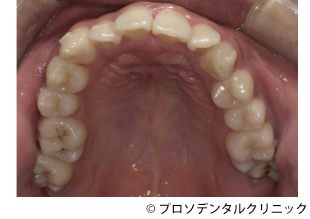 治療前
