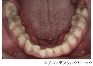 治療前