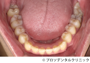 治療後