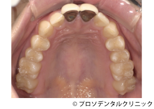 治療前
