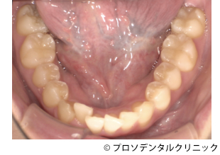 治療前