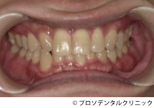 治療前