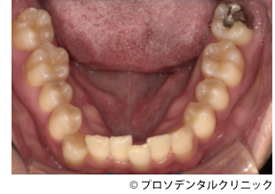 治療前