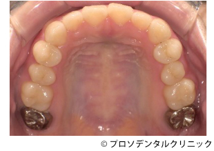 治療前