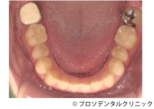治療前