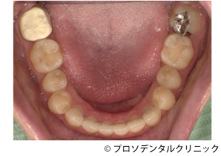 治療後