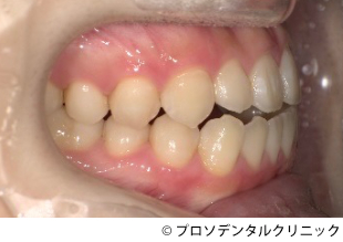 治療前