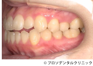 治療前