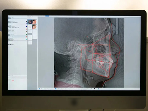 ���ޥ��ﶺ�����ʥ���˥å�