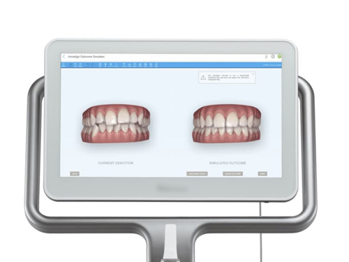 ���ޥ��ﶺ�����ʥ���˥å�