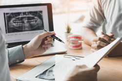 カウンセリングとチーム医療