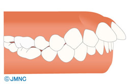 �Фû��μ���