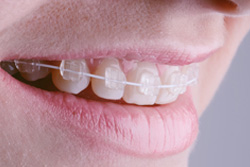 ��Ω���ˤ����磻�䡼����