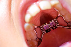 �ܴ��̶�������