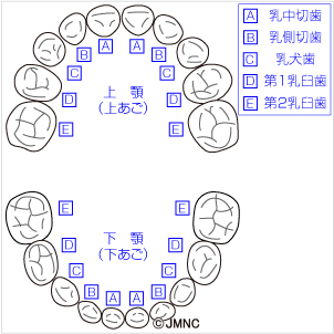 歯並び 不正咬合の無料イラスト素材集 歯科 矯正歯科医院向け 矯正歯科ネット