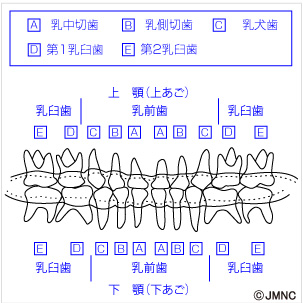 歯並び 不正咬合の無料イラスト素材集 歯科 矯正歯科医院向け 矯正歯科ネット