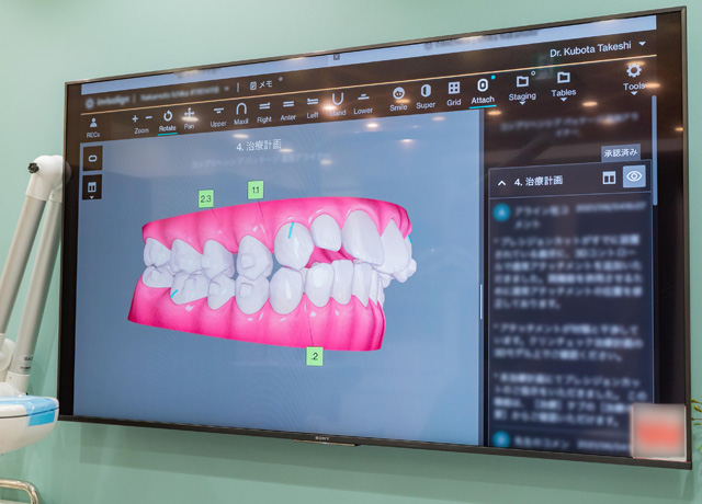 3Dシミュレーションソフト