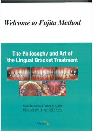 The Philosophy and Art of the Lingual Bracket Treatment
-Welcome to Fujita Method-