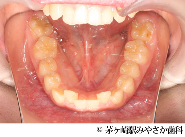 治療前