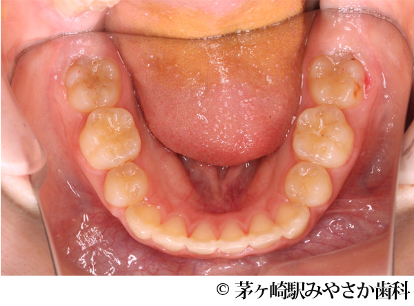 治療後