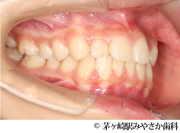 治療前