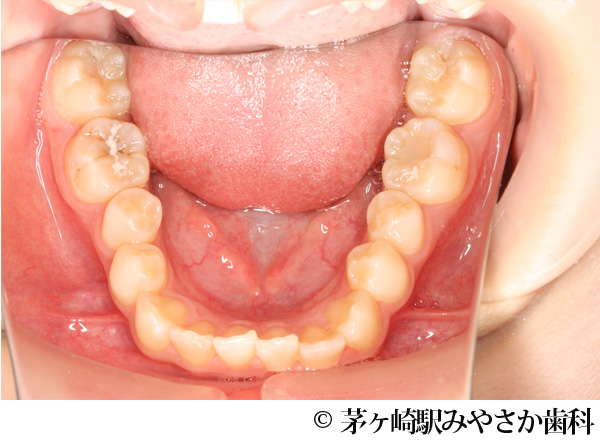 治療前