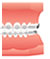 大人の歯列矯正装置