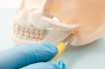 歯列矯正が保険（公的医療保険）適用になる条件とは？