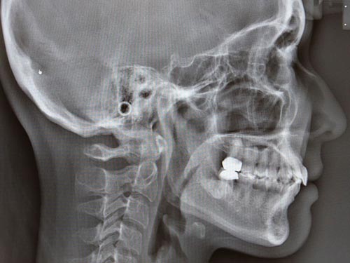 ���ե������ȥ���