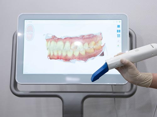 �����⥹�����