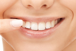 矯正治療とトータルケア