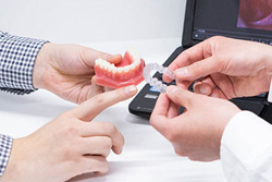 カウンセリング(矯正治療の相談)