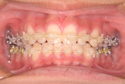 �����֥饱�å�